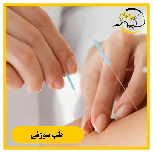 طب سوزنی در شیراز