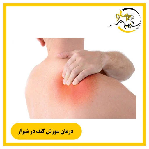 درمان قطعی سوزش کتف در شیراز؛ رهایی پایدار از اسپاسم و گرههای عضلانی
