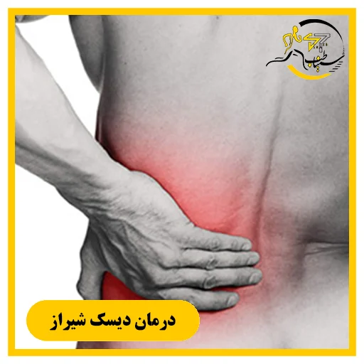 درمان ریشه‌ای دیسک کمر و سیاتیک بدون جراحی در شیراز | فیزیوتراپی سیناطب