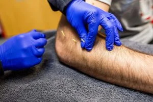 طب سوزنی برای ورزشکاران